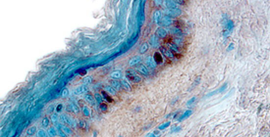 IL-13 Receptor alpha 1 in Human Skin.  Interleukin-13 Receptor alpha 1 (IL-13 R alpha 1) was detected in immersion fixed paraffin-embedded sections of human skin using Human IL-13 R alpha 1 Antigen Affinity-purified Polyclonal Antibody. Tissue was stained using the Anti-Goat HRP-DAB Cell & Tissue Staining Kit (brown) and counterstained with hematoxylin (blue).  ©2014 R&D Systems, Inc. All Rights Reserved.