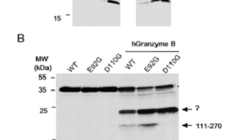 New study reveals key step in allergic reactions.