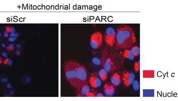 Neurons, brain cancer cells require the same little-known protein for long-term survival.