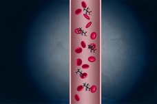 Years before they show any other signs of disease, pancreatic cancer patients have very high levels of certain amino acids in their bloodstream, according to a new study.