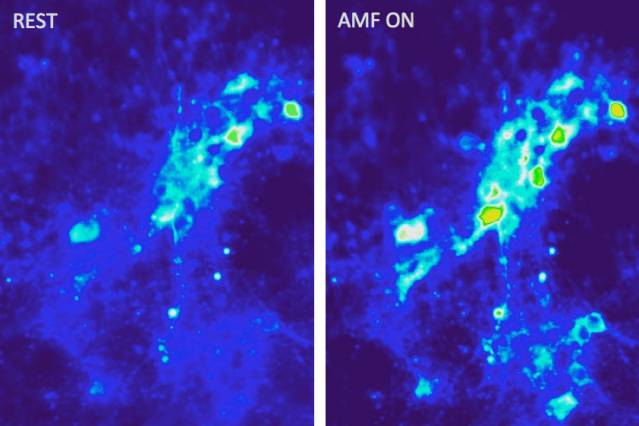 Images show calcium ion influx into neurons as a result of magnetothermal excitation with alternating magnetic fields in the presence of magnetic nanoparticles.
