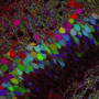 More than 100 years ago, Golgi staining on nerve cells opened the gates to modern neuroscience. Scientists recently developed the Technicolor version of Golgi staining, Brainbow, allowing more detailed reconstructions of brain circuits. More than 100 years ago, Golgi staining on nerve cells opened the gates to modern neuroscience. Scientists recently developed the Technicolor version of Golgi staining, Brainbow, allowing more detailed reconstructions of brain circuits.