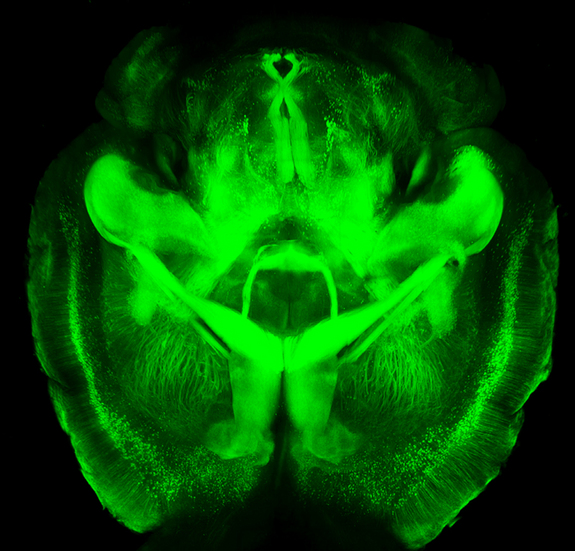 CLARITY mouse brain image