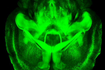 CLARITY mouse brain image