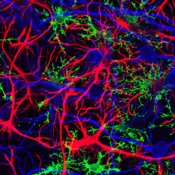glial cells, brain